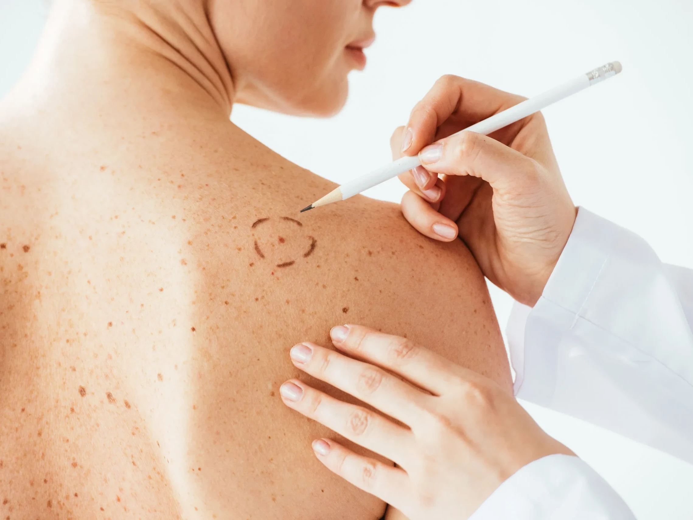 dermatologia
